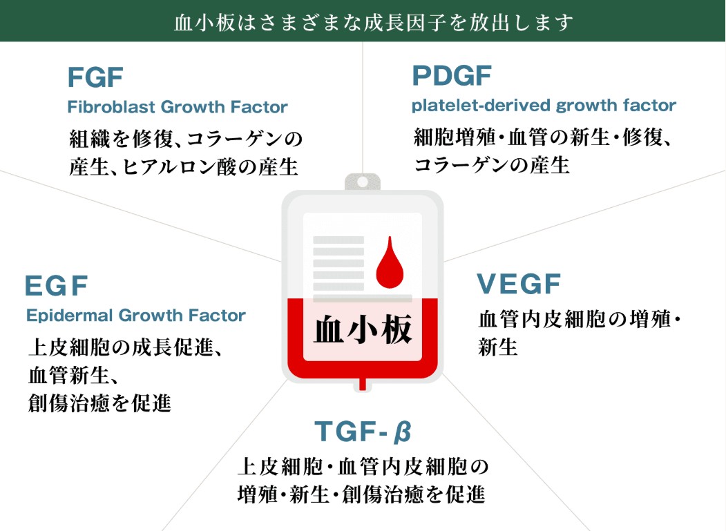 PRP（多血小板血漿）治療