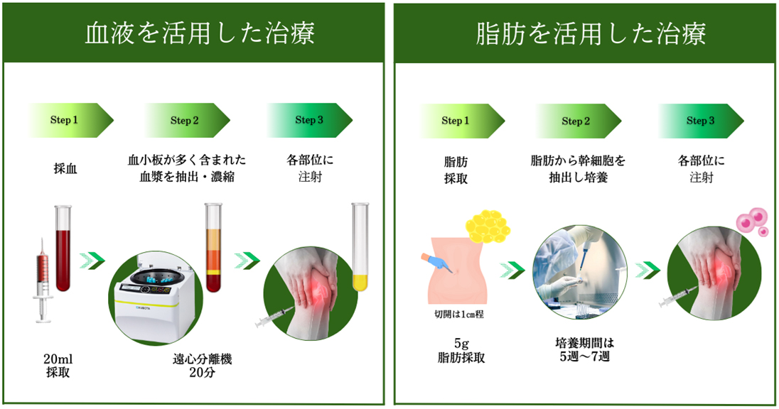 血液を活用した治療・脂肪を活用した治療