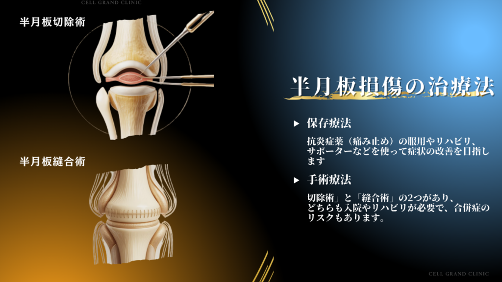 半月板損傷の治療法