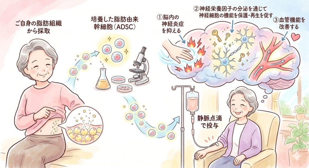 靈智醫學と治病 認知症・アルツハイマー病の再生医療｜幹細胞治療の費用・効果
