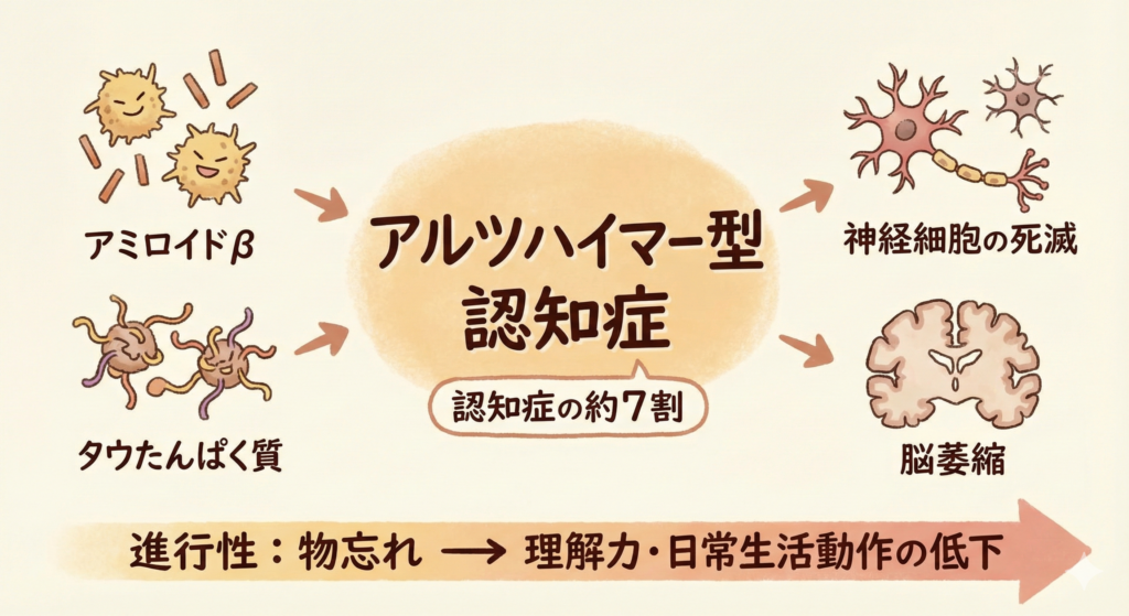 アルツハイマー型認知症の説明