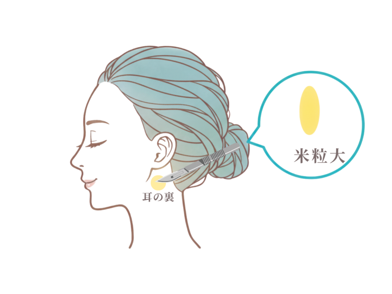 皮膚組織の採取