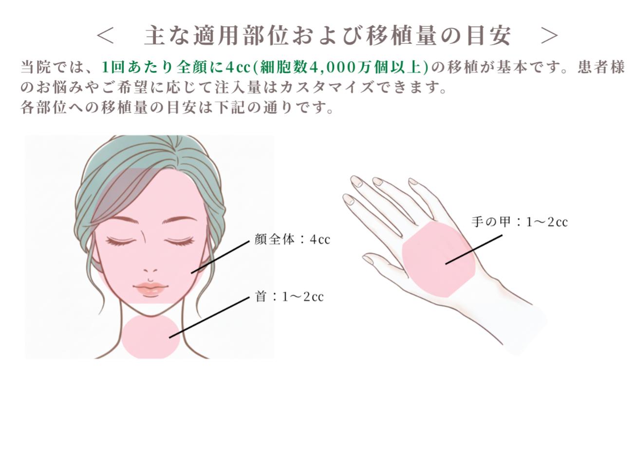 主な適用部位および移植量の目安