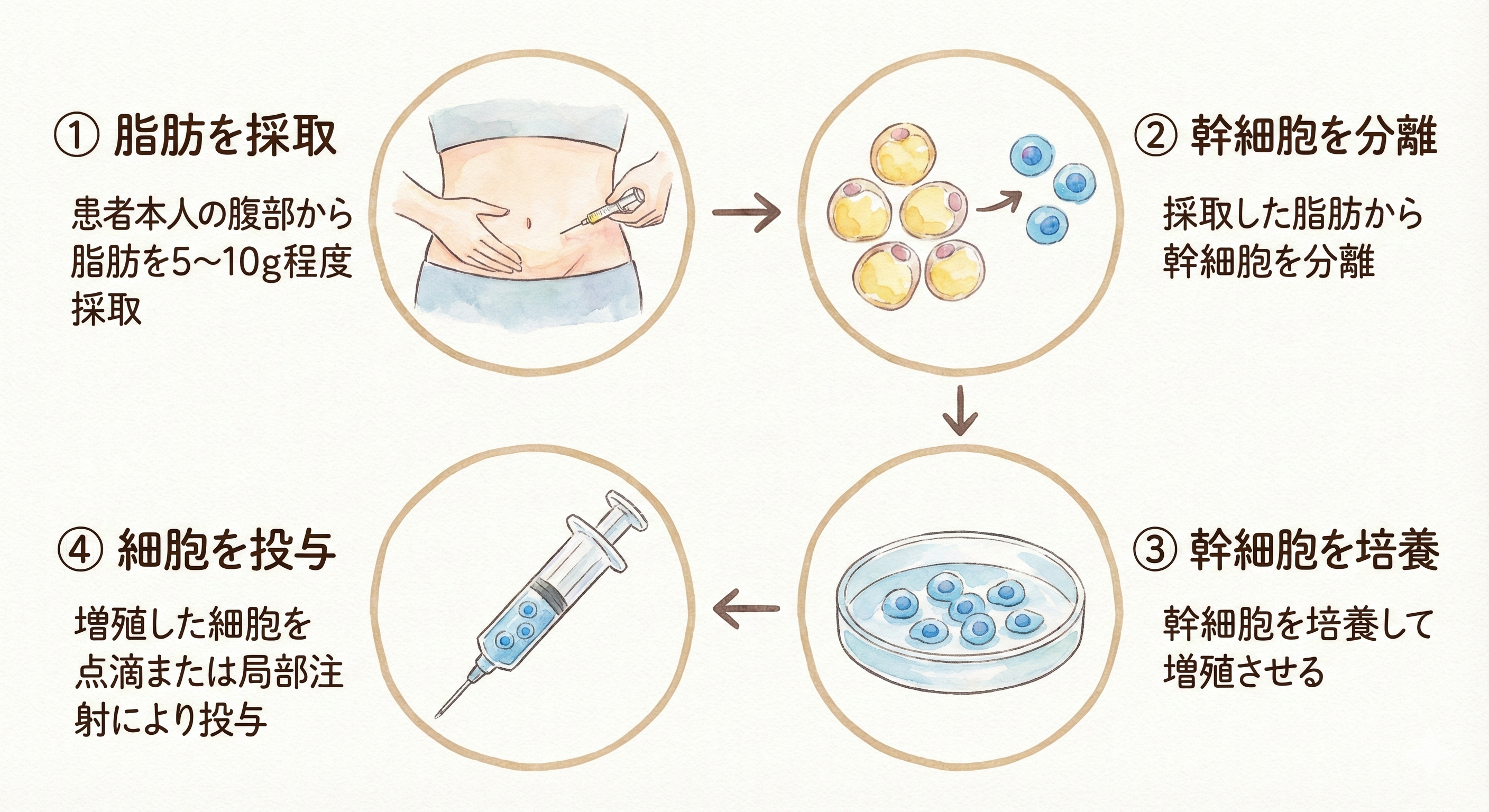幹細胞治療の流れ