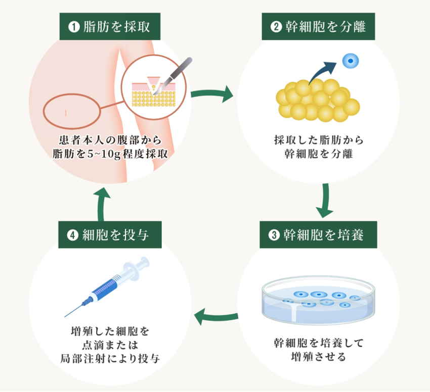 エクソソーム治療