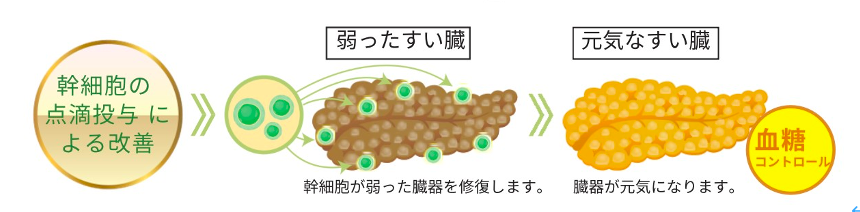 自己脂肪由来幹細胞治療