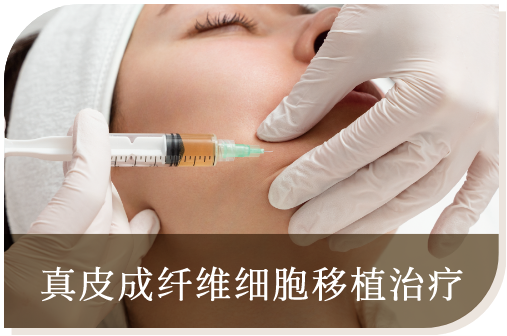 真皮成纤维细胞移植治疗