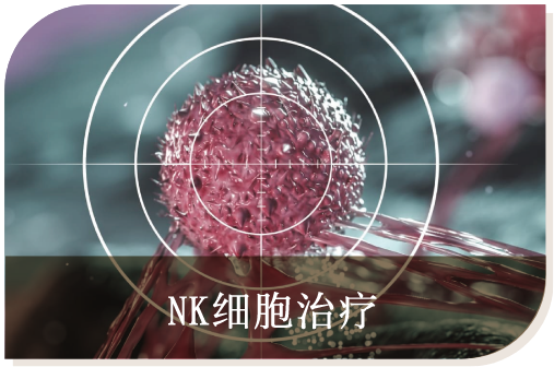 NK细胞治疗