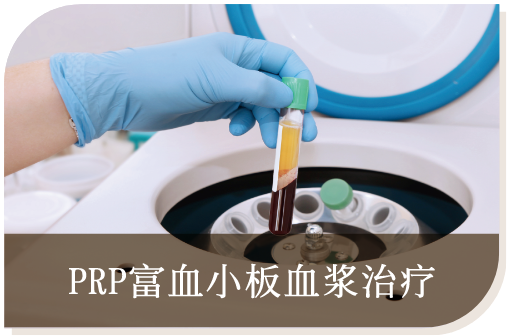PRP富血小板血浆治疗