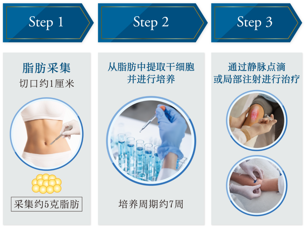 自体脂肪由来干细胞治疗流程
