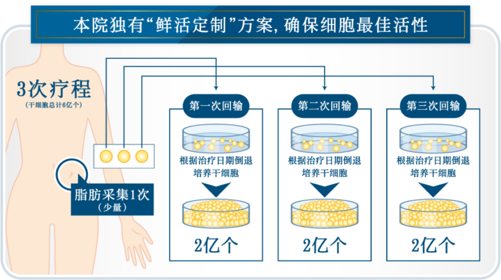 本院独有“鲜活定制”方案,确保细胞最佳活性