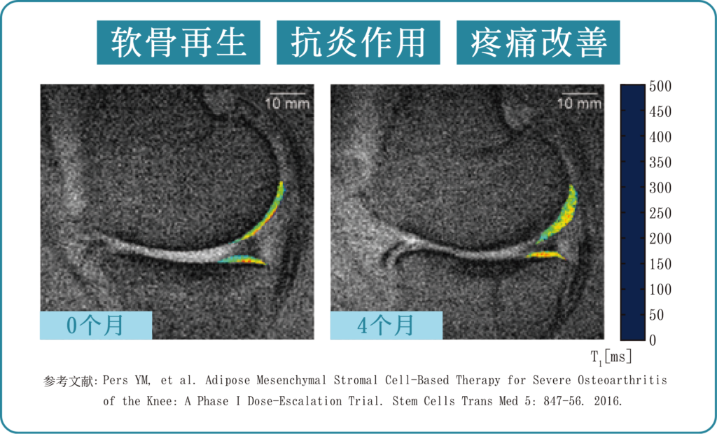 软骨再生・抗炎作用・疼痛改善
