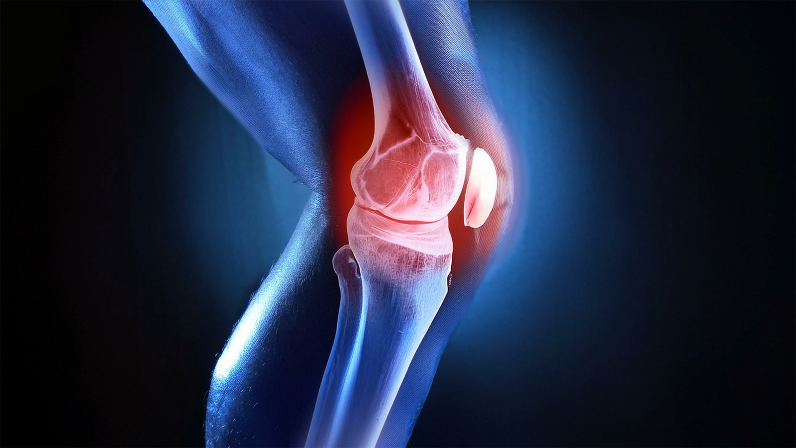 Stem Cell Therapy for Knee Osteoarthritis: A Non-Surgical Treatment Backed by Clinical Evidence | Cell Grand Clinic