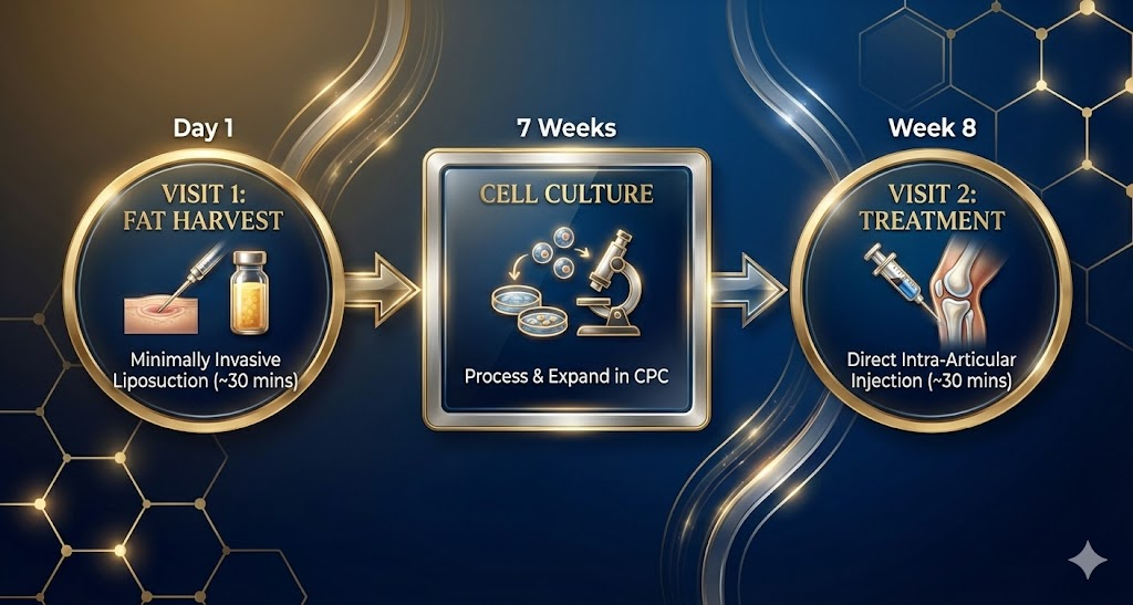 Treatment Process for stem cell therapy for Knee pain