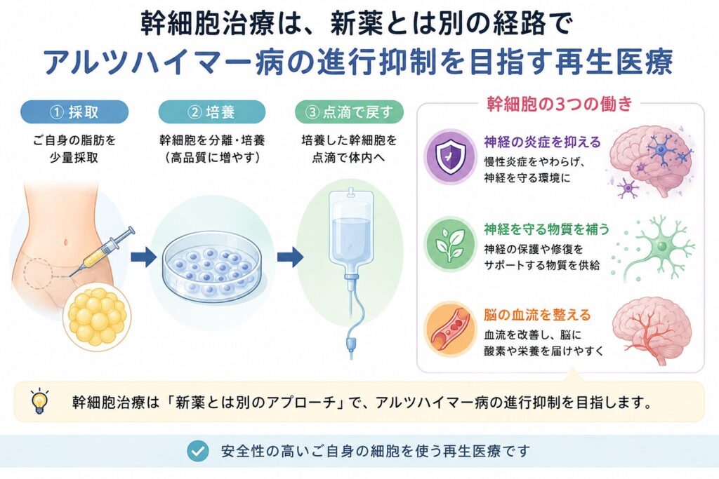 幹細胞治療は、ご自身の脂肪から採取・培養した幹細胞を点滴で戻し、神経の炎症を抑える・神経を守る物質を補う・脳の血流を整える、という新薬とは別の経路で進行の抑制を目指す再生医療です。